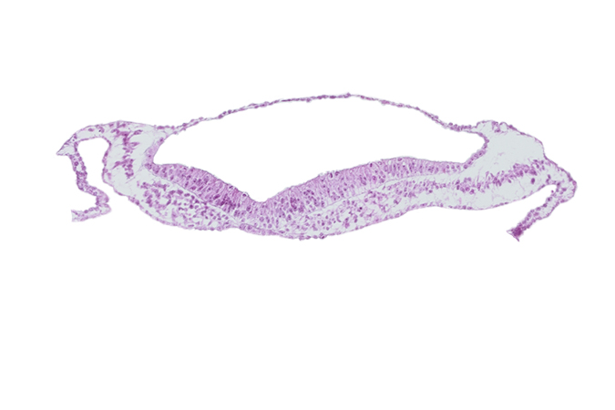 amniotic cavity, head mesenchyme, isolated coelomic space, notochordal plate, umbilical vesicle cavity