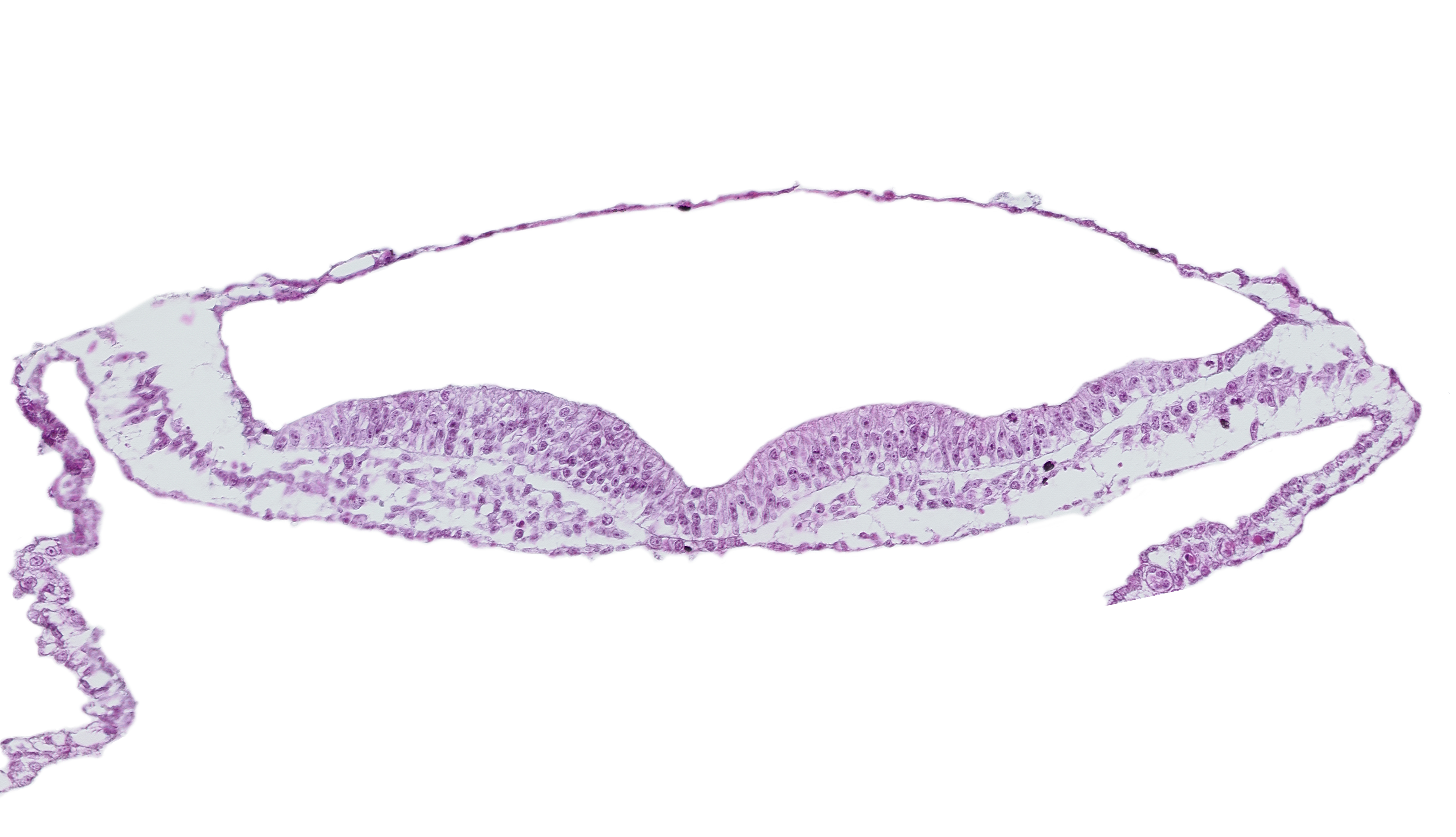 amnion, amniotic cavity, extra-embryonic endoderm