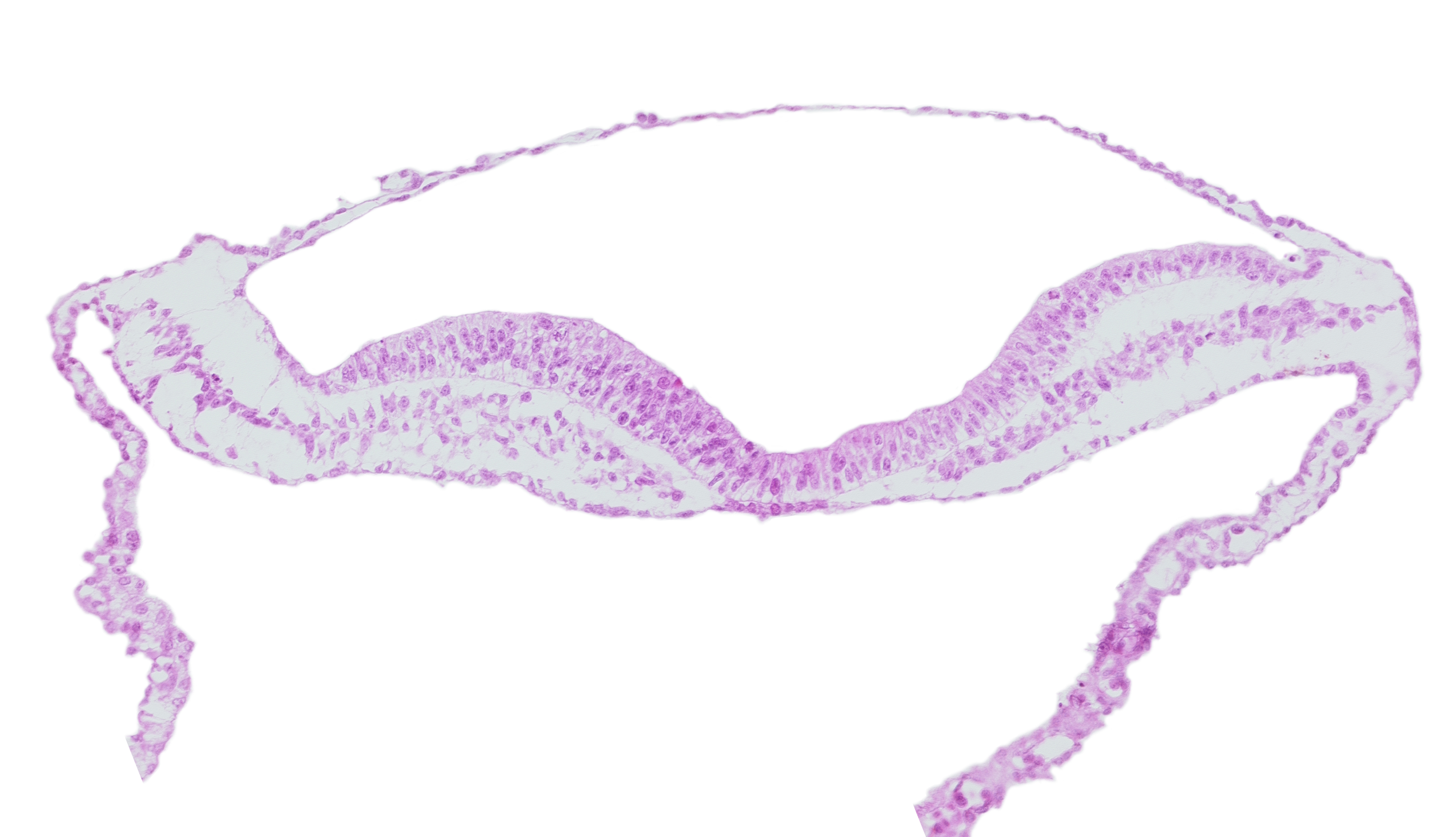 endoderm, neural fold, neural groove, umbilical vesicle hemangiogenesis