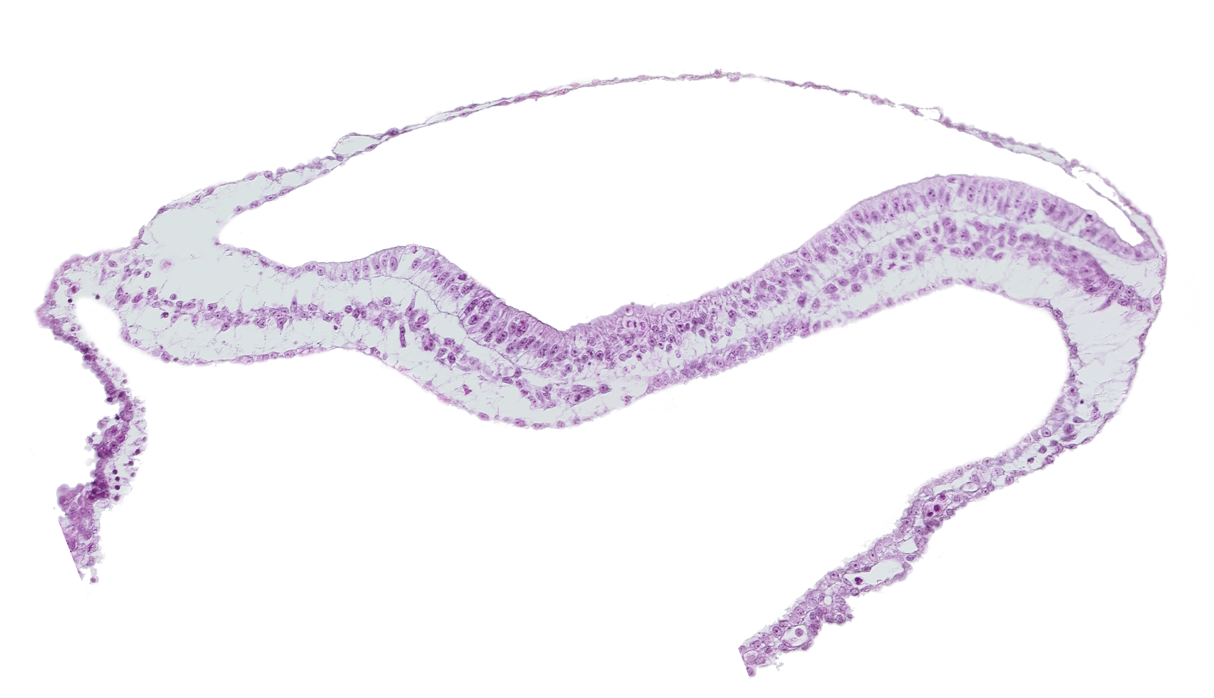 amnion, amniotic cavity, head mesenchyme, neural fold, neural groove, notochordal process