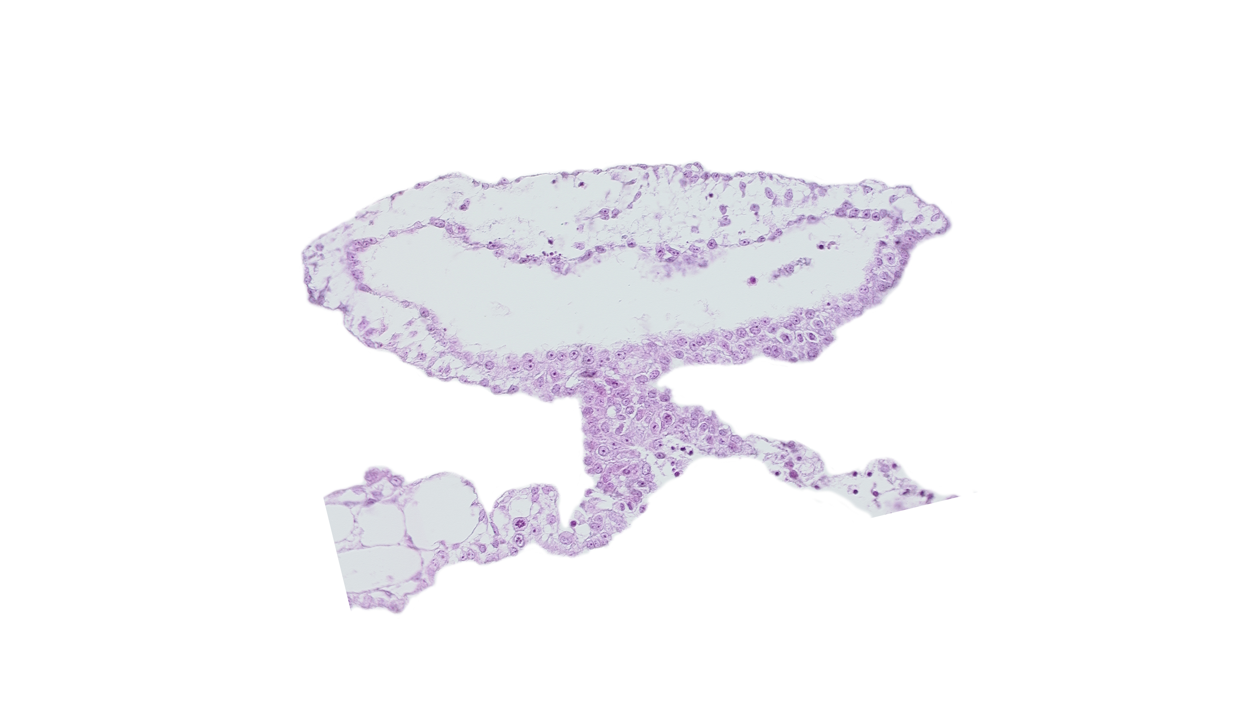 umbilical vesicle cavity