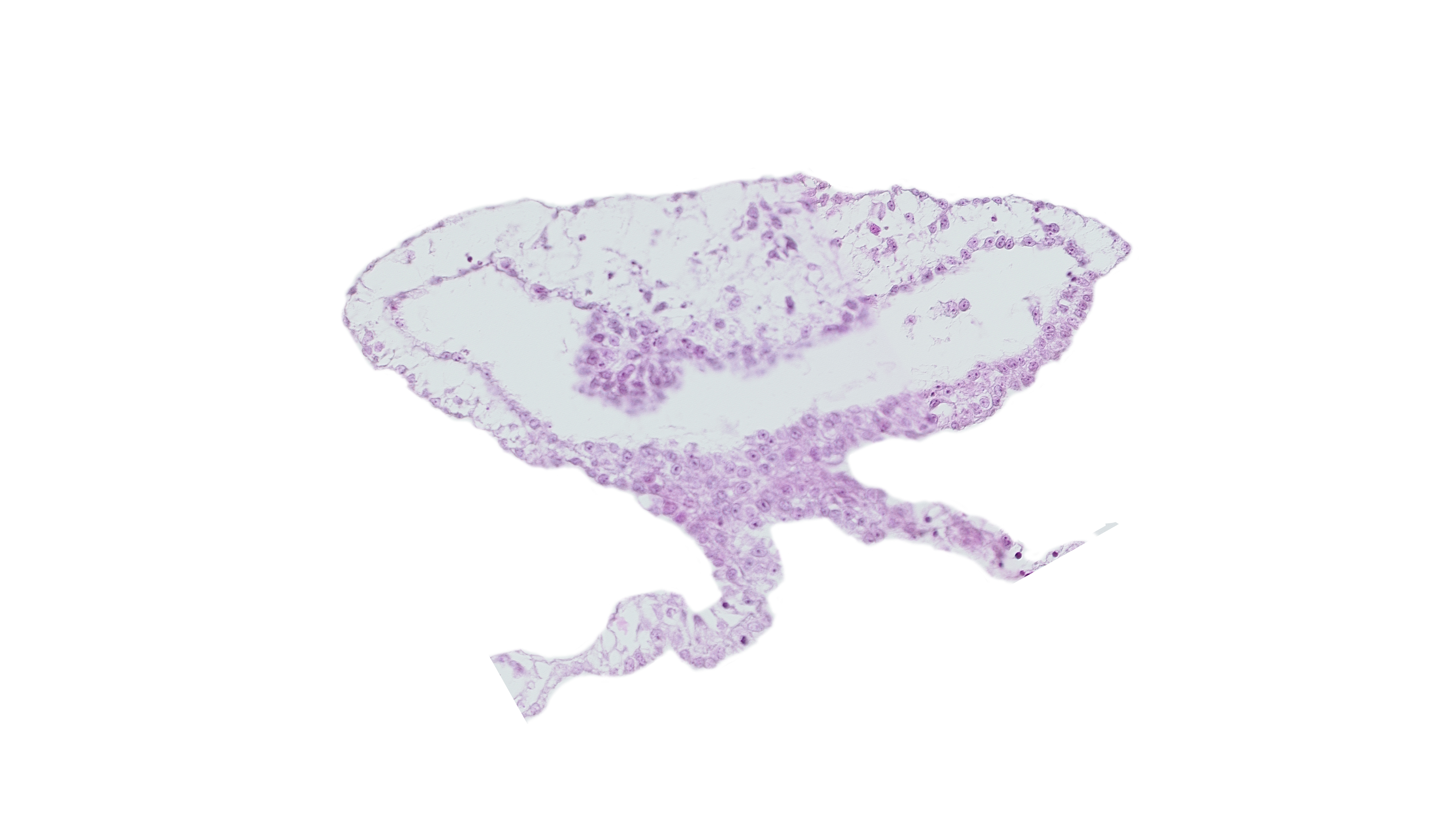 cephalic edge of cardiac mesoderm, continuity of umbilical vesicle wall, umbilical vesicle cavity