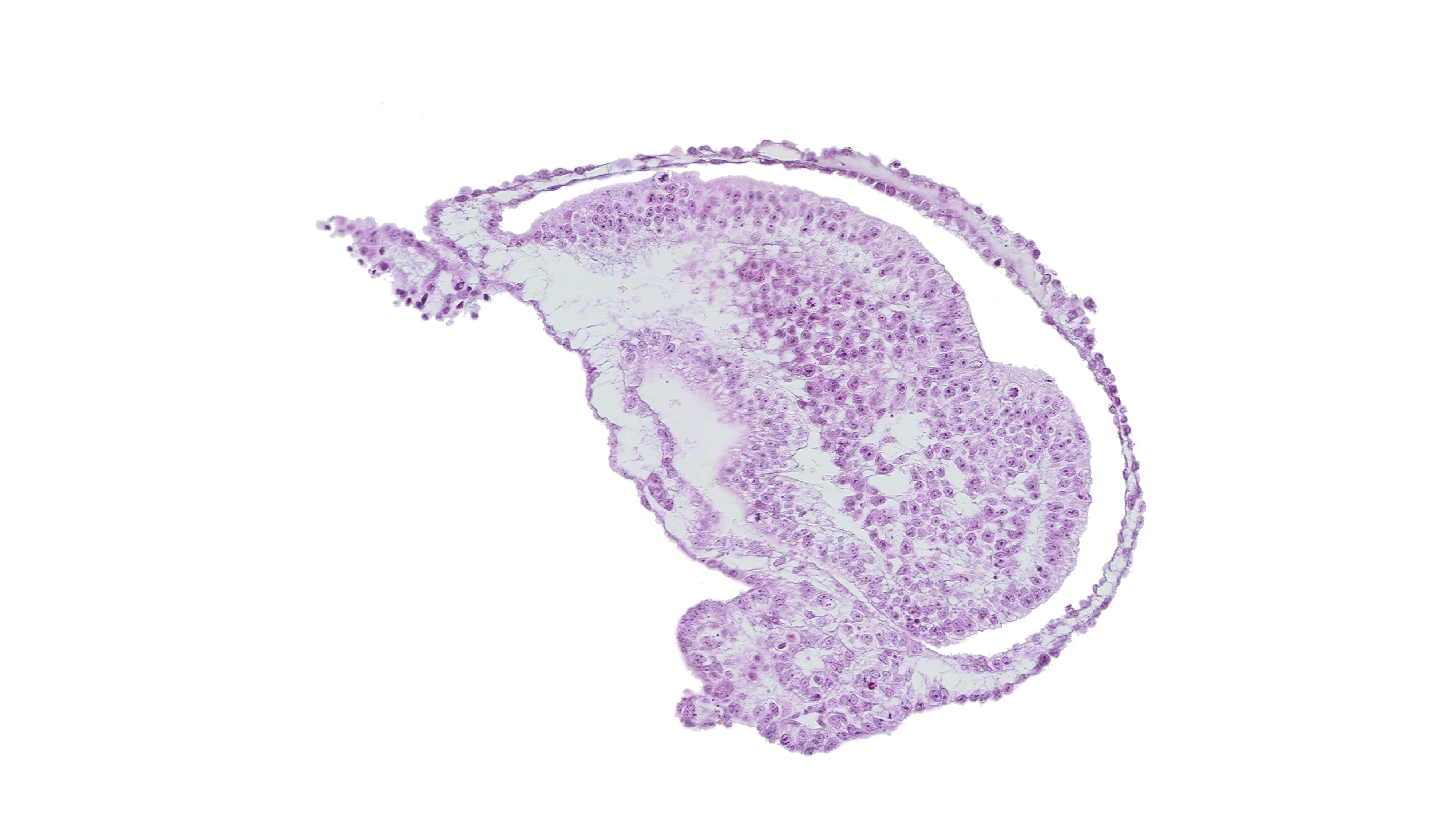 allantoic diverticulum, amnion, amniotic cavity, connecting stalk, extra-embryonic coelom, gastrulation (primitive) groove, gastrulation (primitive) streak