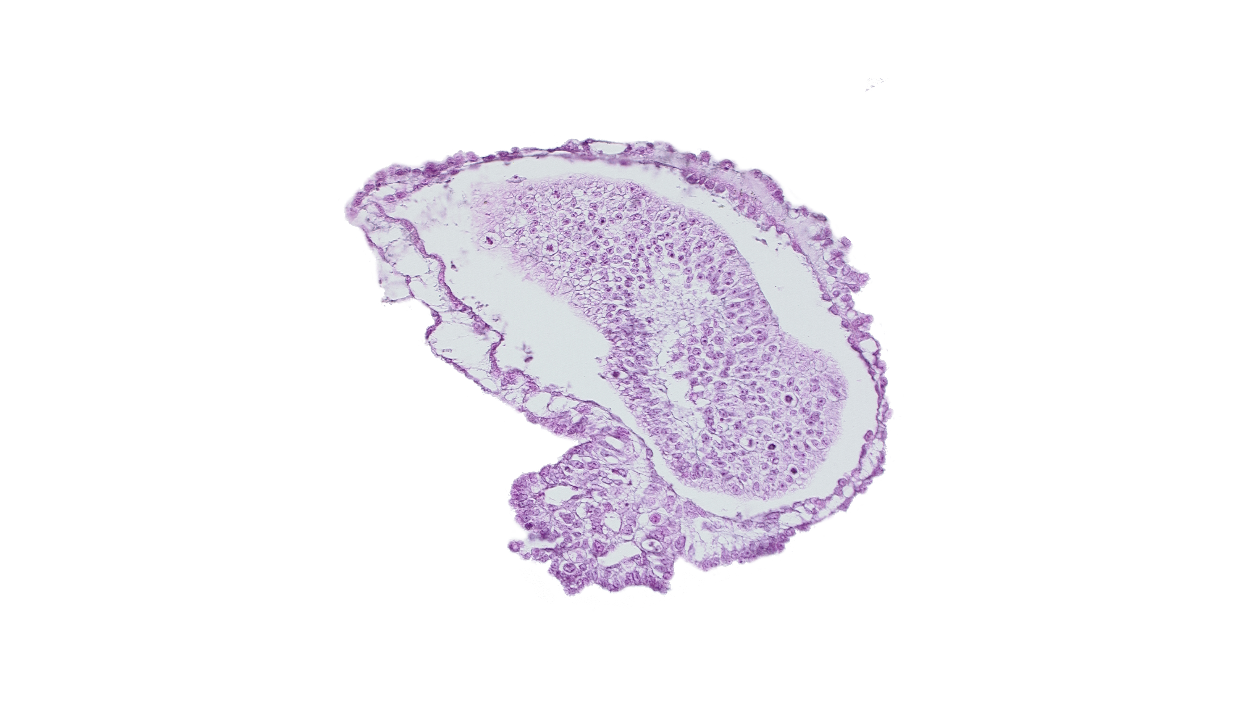 allantoic diverticulum in connecting stalk, amniotic cavity, caudal eminence, gastrulation (primitive) groove