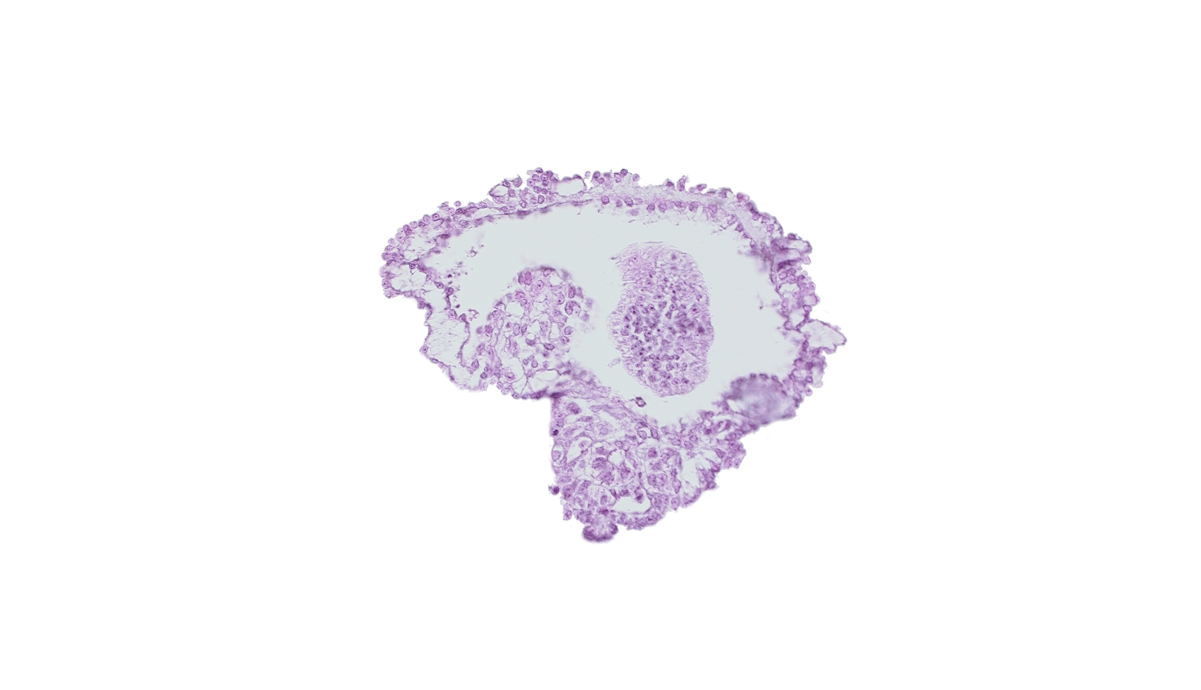 allantoic diverticulum in connecting stalk