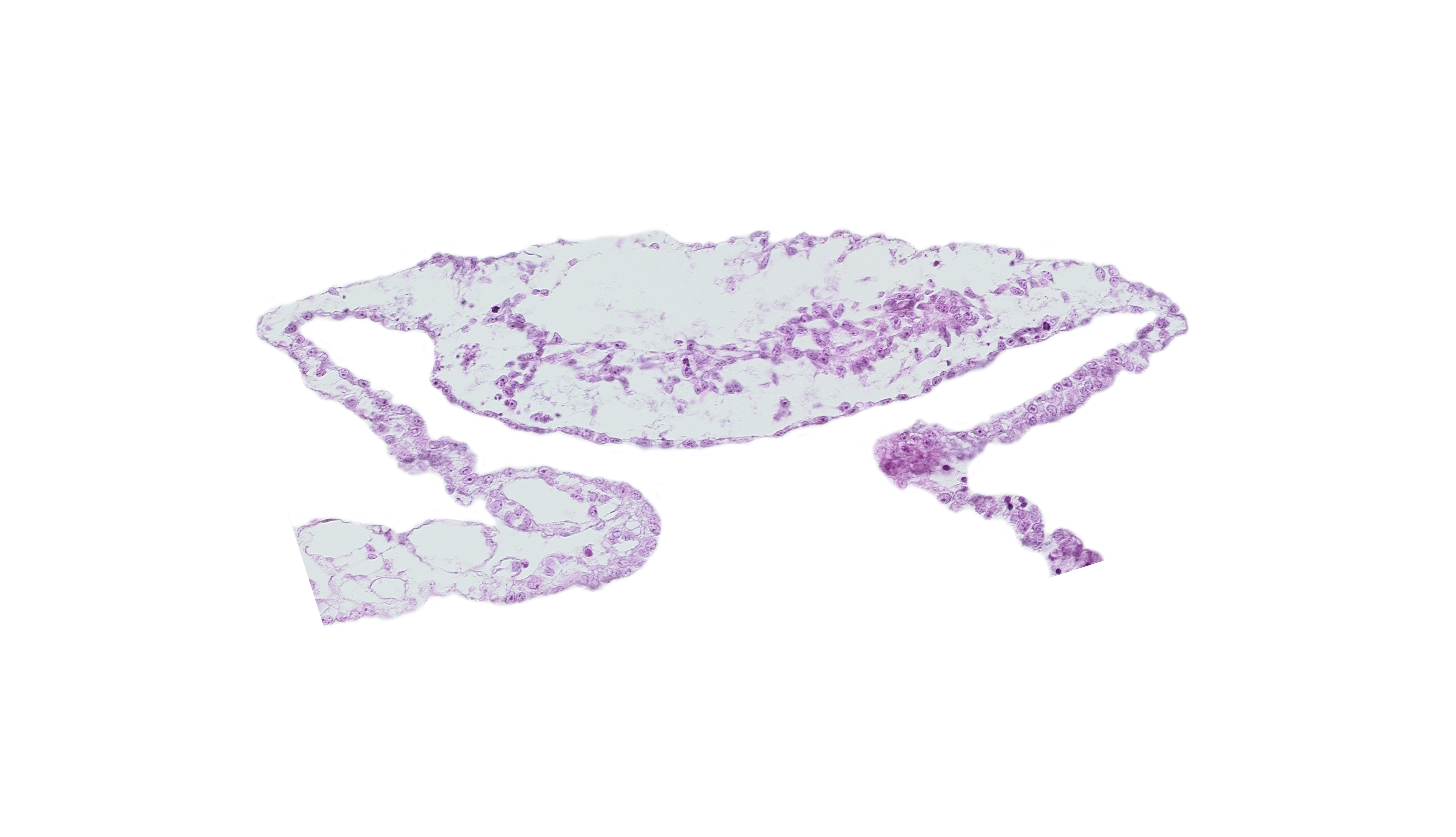 blood vessel(s), cardiac mesoderm, extra-embryonic mesoderm, umbilical vesicle cavity