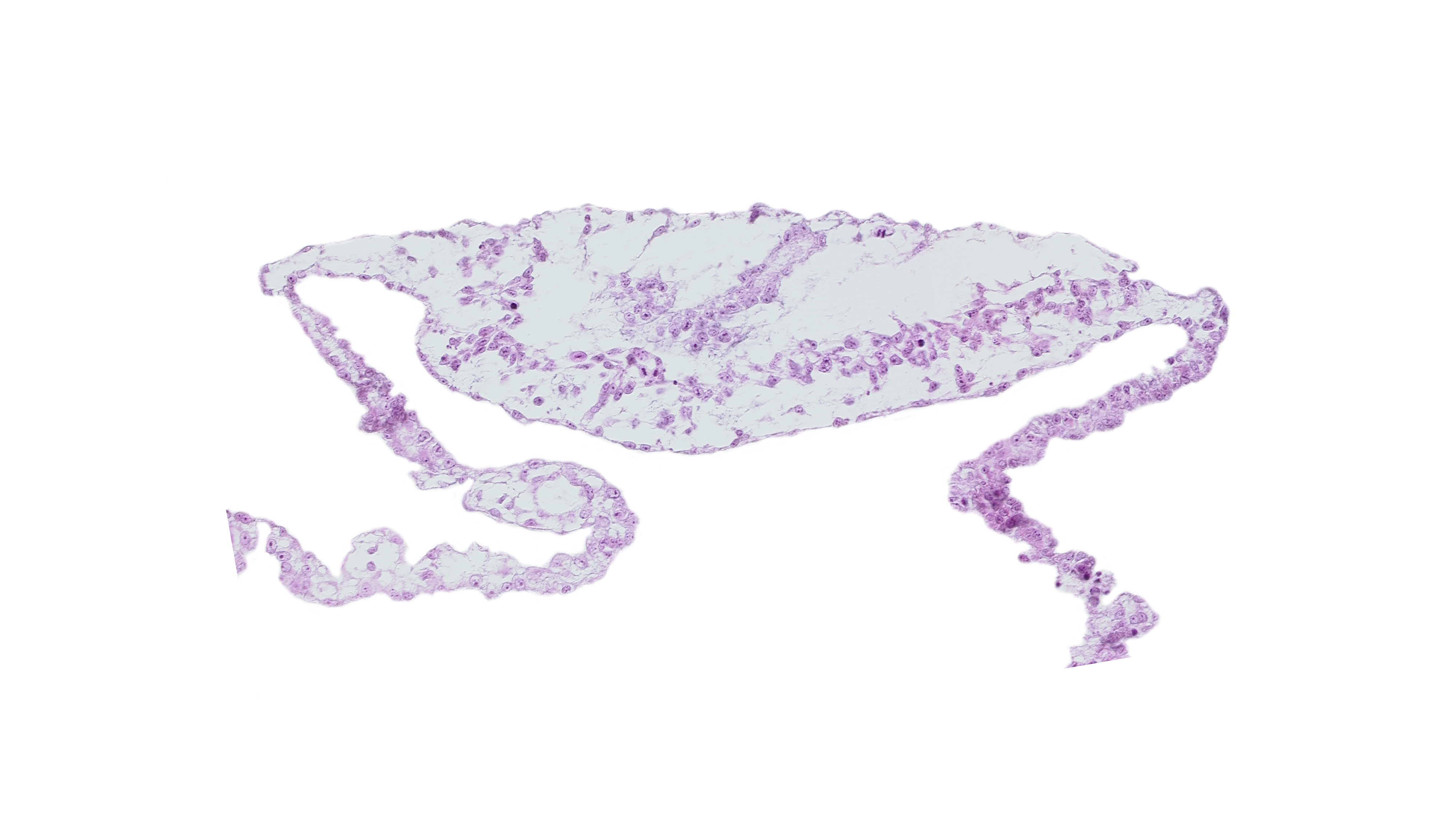 cephalic edge of neural plate, junction of cardiac mesoderm and head mesenchyme