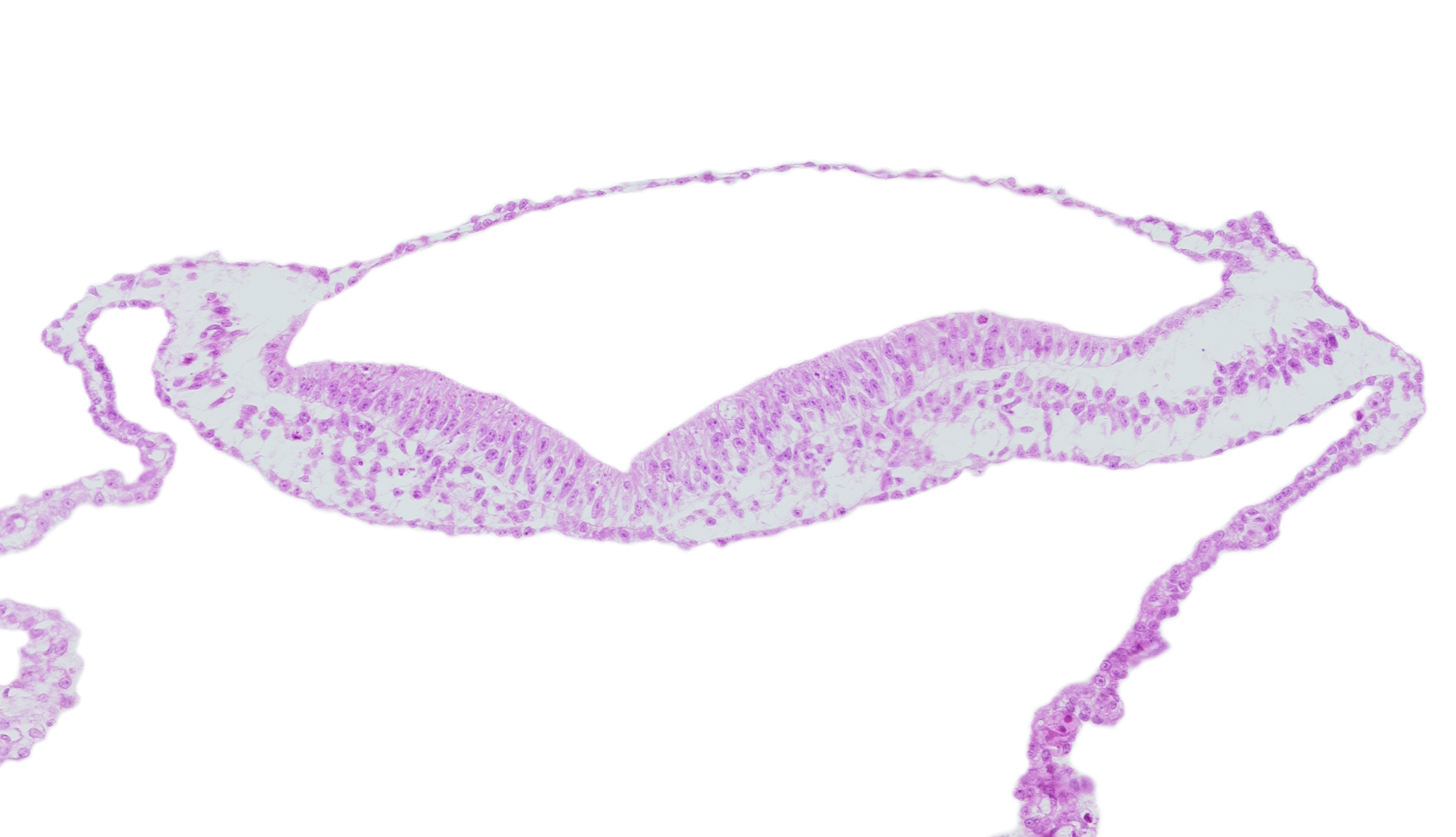 head mesenchyme, neural fold, neural groove, notochordal plate