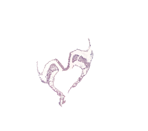 artifact separation(s), notochordal plate, spinal cord primordium