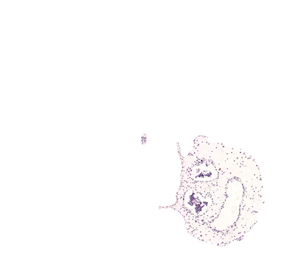 amnion attachment, amniotic cavity, caudal edge of caudal eminence, common umbilical artery, connecting stalk, left umbilical vein, right umbilical vein