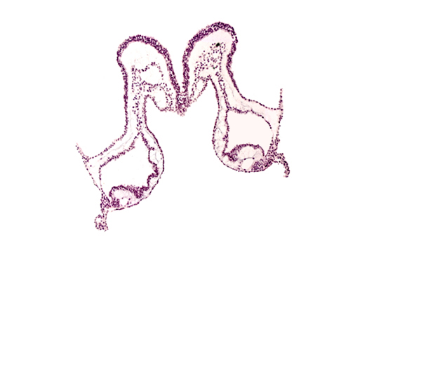 head mesenchyme, isthmus of rhombencephalon, junction of mesencephalon and rhombencephalon, neural fold, presumptive left atrium, surface ectoderm