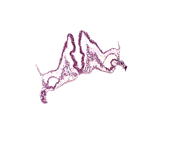 primordial otic placode, rhombomere A (Rh. A), rhombomere B (Rh. B), rhombomere C (Rh. C)