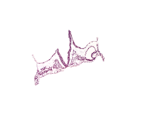 head mesenchyme, primordial left dorsal aorta, primordial otic placode, primordial right dorsal aorta, rhombomere A (Rh. A), rhombomere B (Rh. B), rhombomere C (Rh. C), right vitelline (omphalomesenteric) vein, surface ectoderm