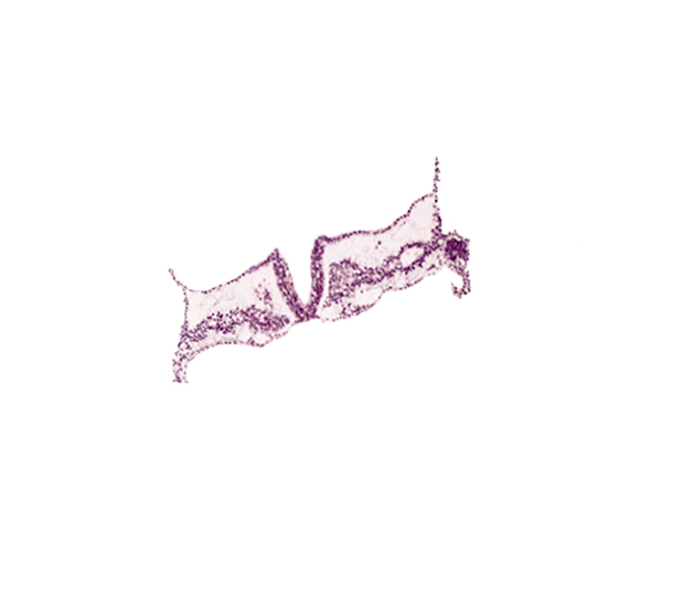 caudal edge of somite 1 (O-1), intermediate mesenchyme, intra-embryonic coelom, neural plate, somite 1 (O-1), somite 2 (O-2), umbilical vesicle attachment