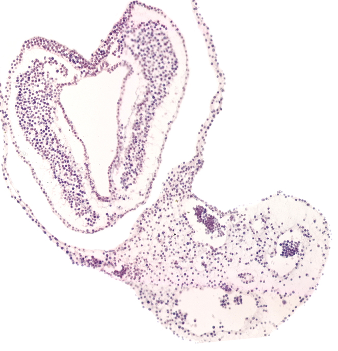 left umbilical artery, left umbilical vein, notochordal (primitive) pit, right umbilical artery, right umbilical vein, tail fold region