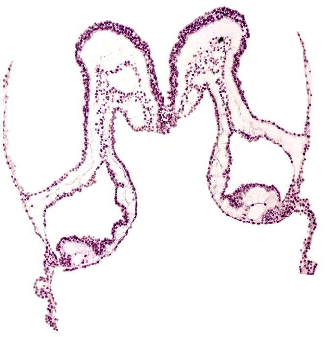 head mesenchyme, isthmus of rhombencephalon, junction of mesencephalon and rhombencephalon, neural fold, presumptive left atrium, surface ectoderm