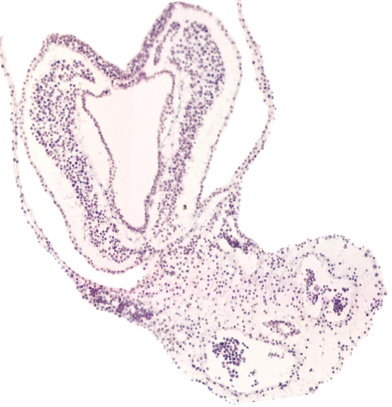 allantoic diverticulum, connecting stalk, left umbilical artery, notochordal (primitive) pit, presumptive cloacal membrane, right umbilical artery