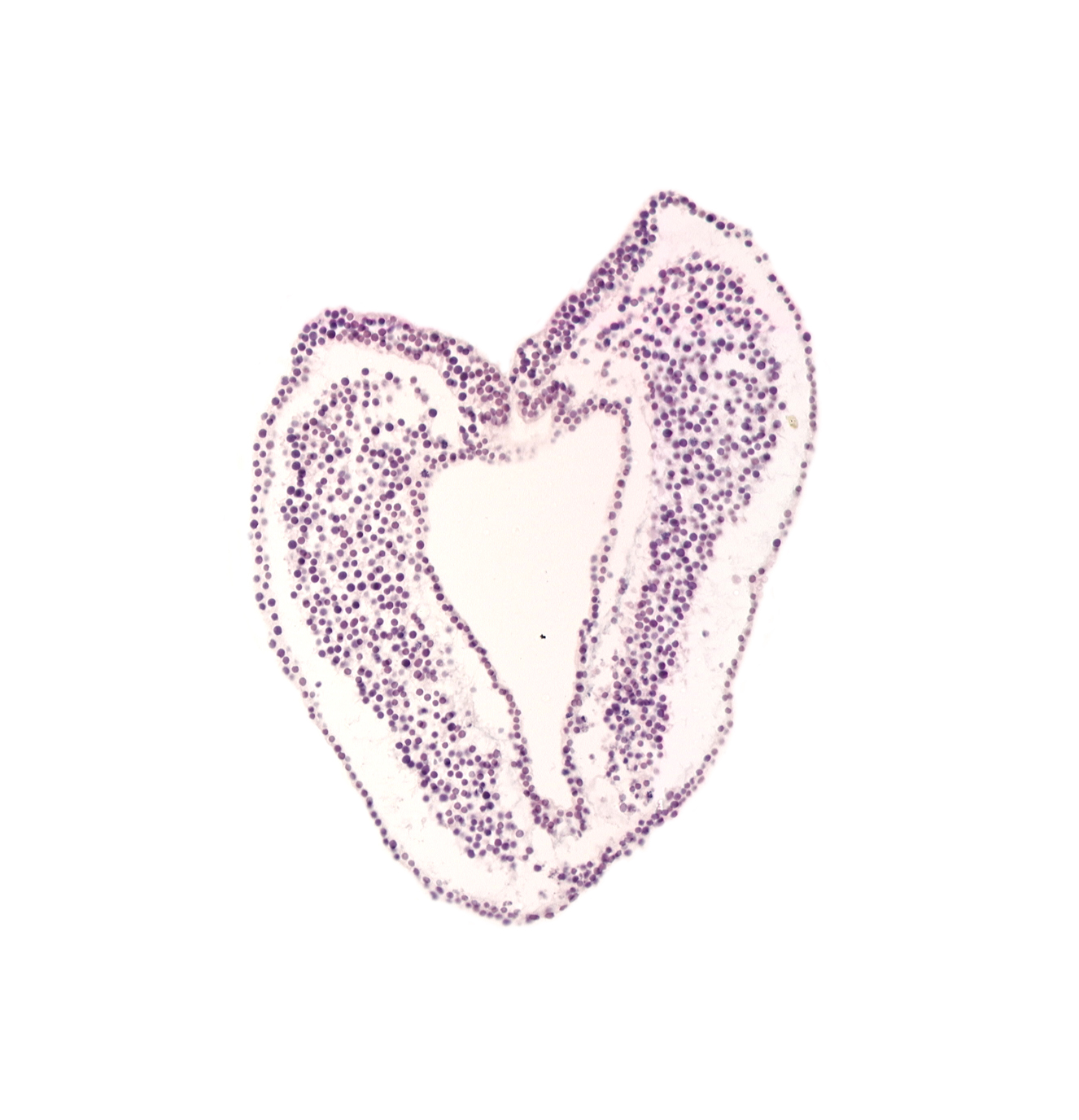 hindgut primordium (lumen), neurenteric canal, notochordal (primitive) pit