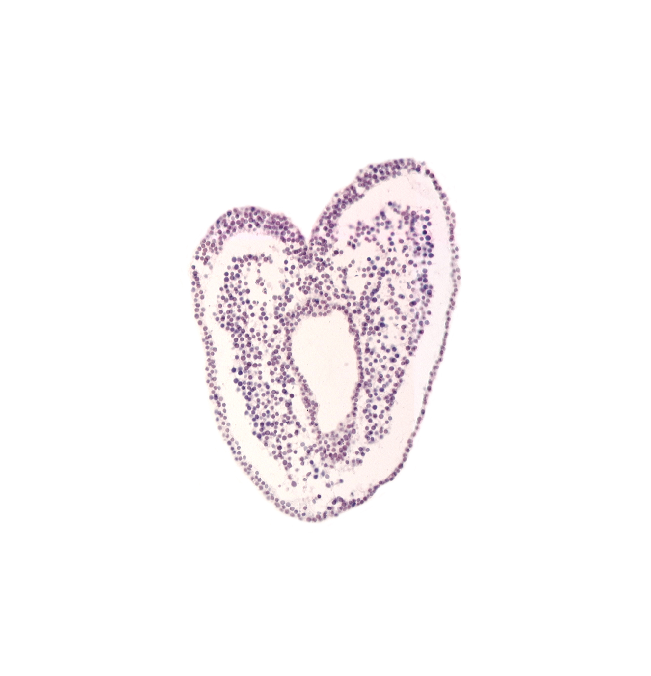 allantoic diverticulum, amnion attachment, common umbilical vein, gastrulation (primitive) streak, hindgut primordium (lumen), left umbilical artery, neural cord, right umbilical artery