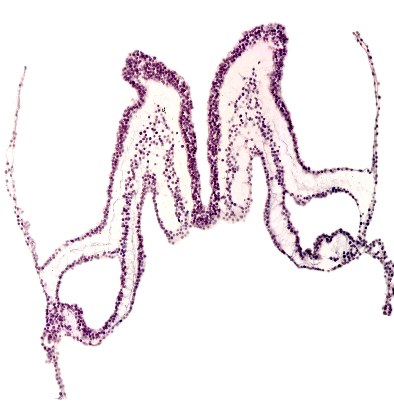 head mesenchyme, midgut primordium (lumen), neural fold, neural groove, notochordal plate, surface ectoderm