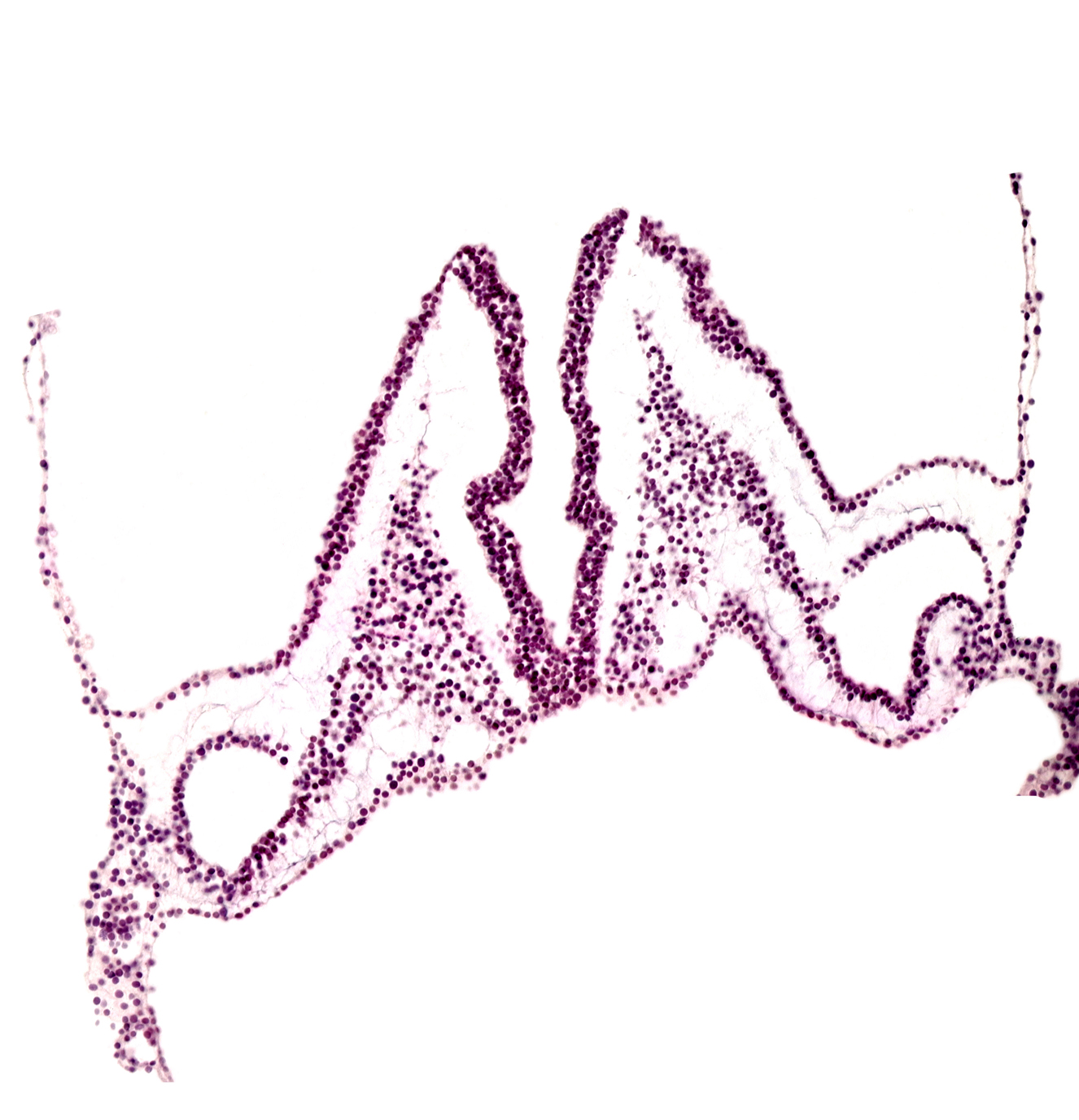 amniotic cavity, artifact separation(s), endoderm, extra-embryonic coelom, head mesenchyme, intra-embryonic coelom, left vitelline (omphalomesenteric) artery, notochordal plate, primordial left dorsal aorta, rhombomere B (Rh. B), rhombomere C (Rh. C), right vitelline (omphalomesenteric) artery, somatopleuric mesoderm, splanchnopleuric mesoderm, surface ectoderm, umbilical vesicle cavity