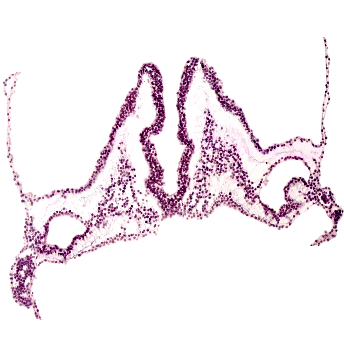 primordial otic placode, rhombomere A (Rh. A), rhombomere B (Rh. B), rhombomere C (Rh. C)