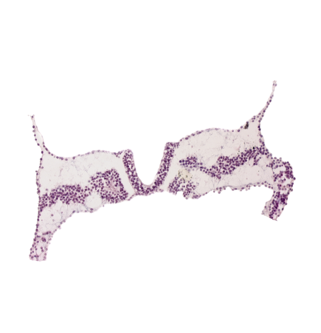 caudal edge of somite 3, cephalic edge of somite 4 (O-4), lateral plate mesoderm, somite 4 (O-4)