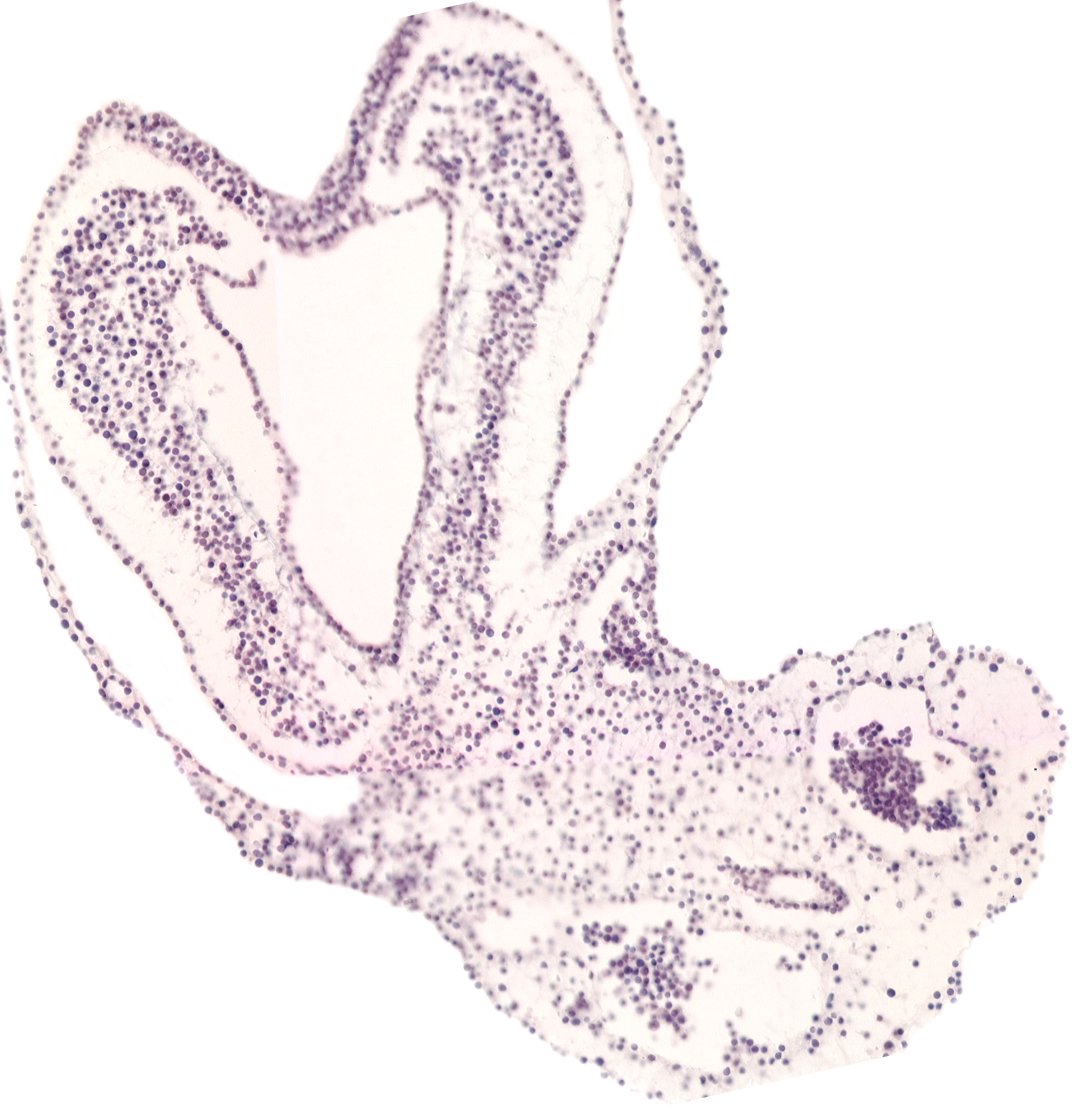 allantoic diverticulum, connecting stalk, hindgut primordium (lumen), left umbilical vein, right umbilical vein