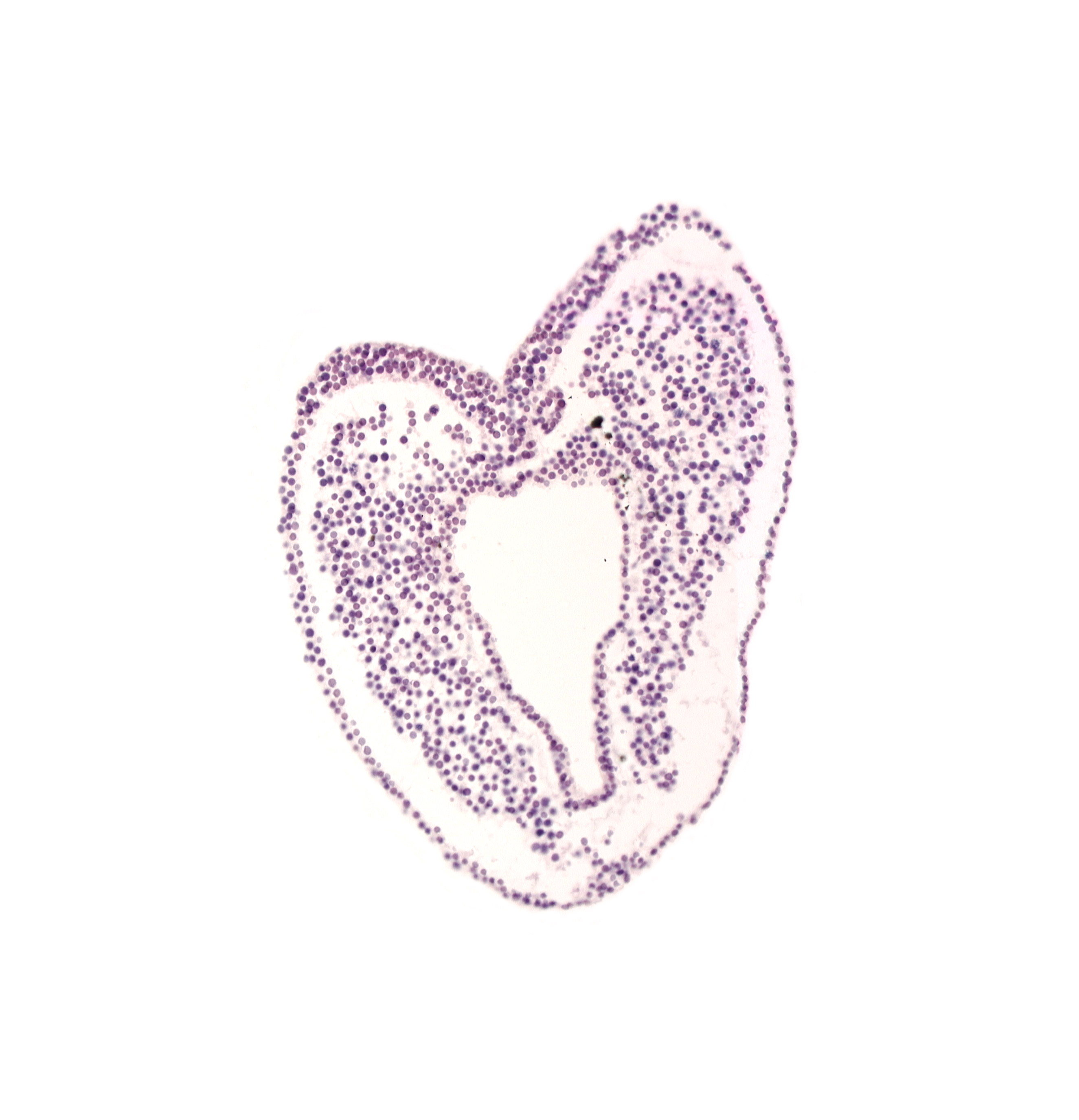 allantois, common umbilical vein, connecting stalk, neural vesicle, ventral ectodermal ridge