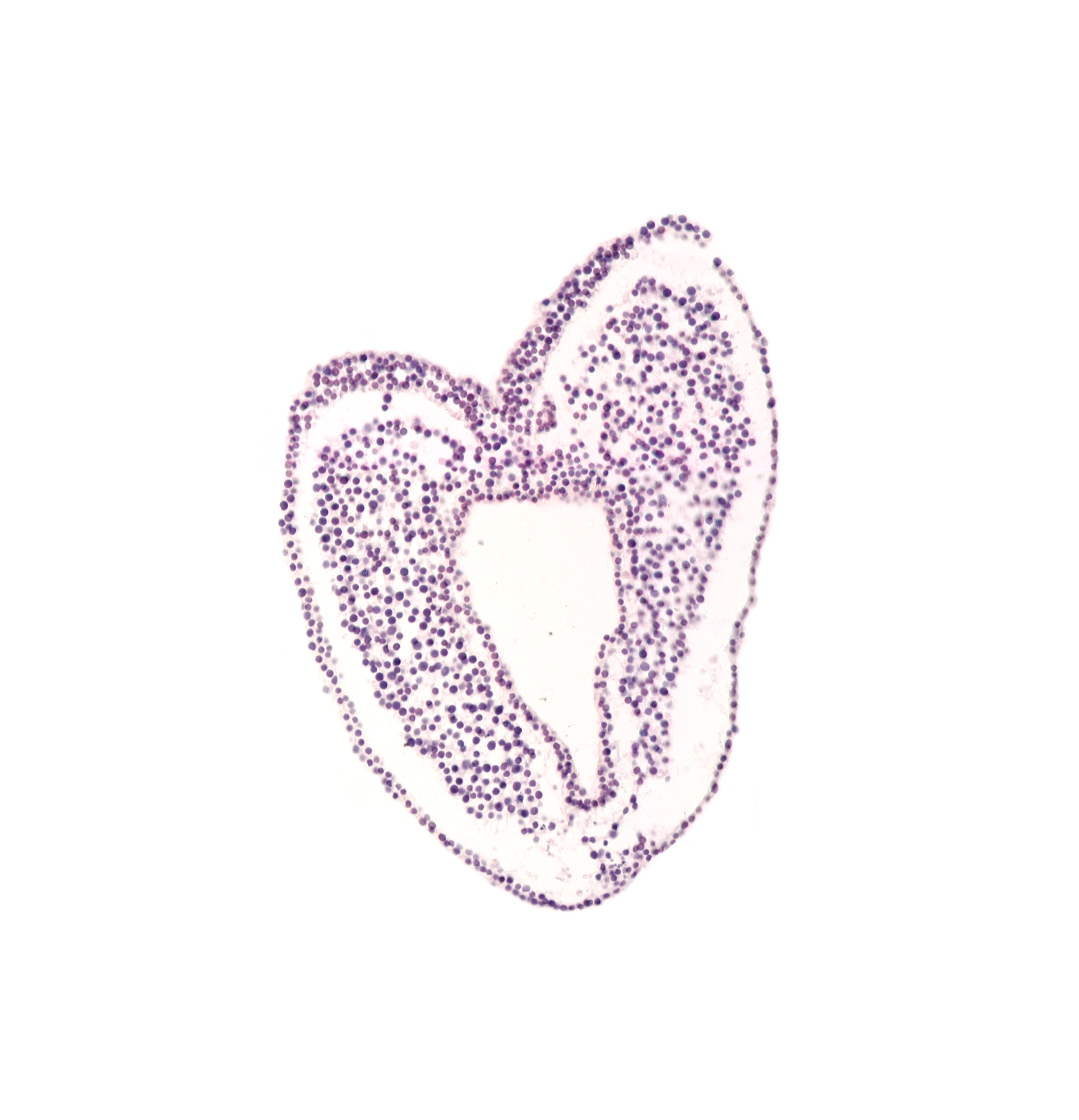 allantoic diverticulum, cephalic part of gastrulation (primitive) streak, common umbilical vein, hindgut primordium (lumen), left umbilical artery, mesoderm, neural cord, right umbilical artery