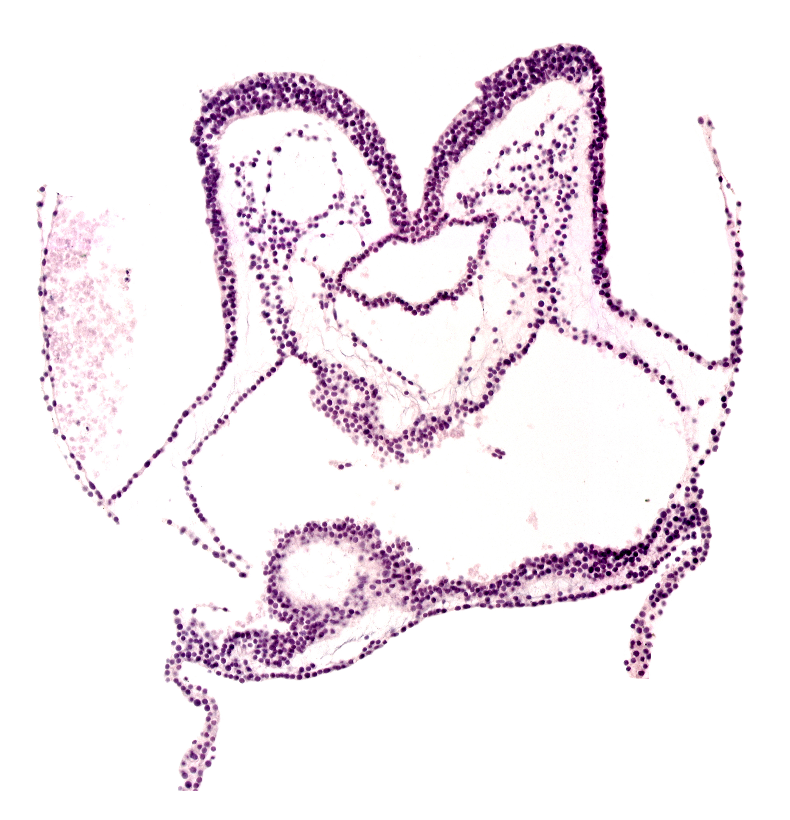 aortic arch 1, cardiac jelly, mesencephalon primordium (M), pharyngeal pouch 1, primordial epimyocardium, primordial left dorsal aorta, primordial neural crest (artifact separation), primordial pericardial cavity, primordial right dorsal aorta, region of mesencephalic (cephalic) flexure