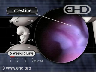 Play Movie - Physiologic Herniation