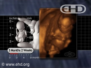 Play Movie - 3 months 2 weeks fetus, Gender Differences