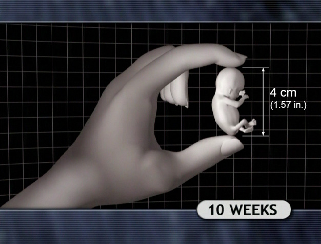 10 weeks fetus size