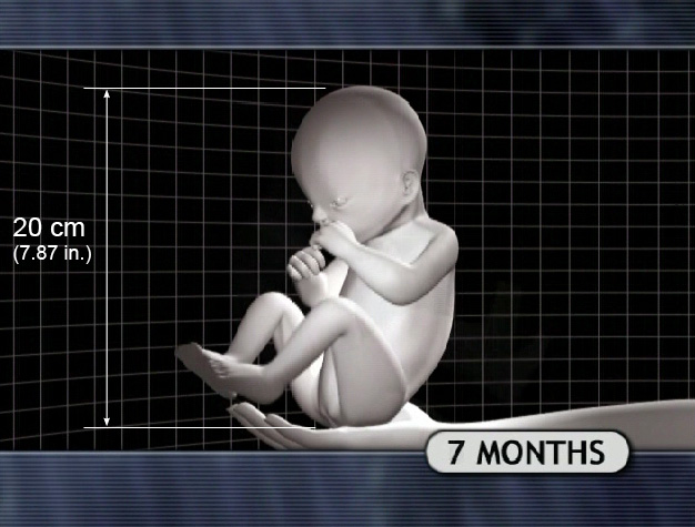 7 Month Fetus