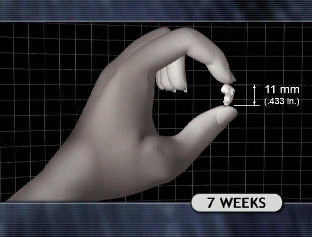7 Week Embryo