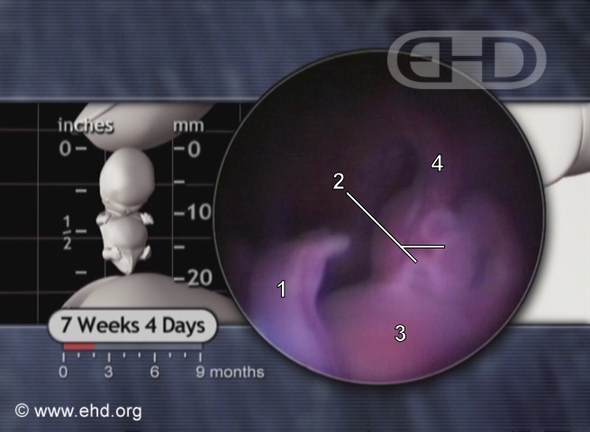 The Umbilical Cord at 7Â½ Weeks