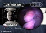 Close-up, Umbilical Cord at 7½ Weeks