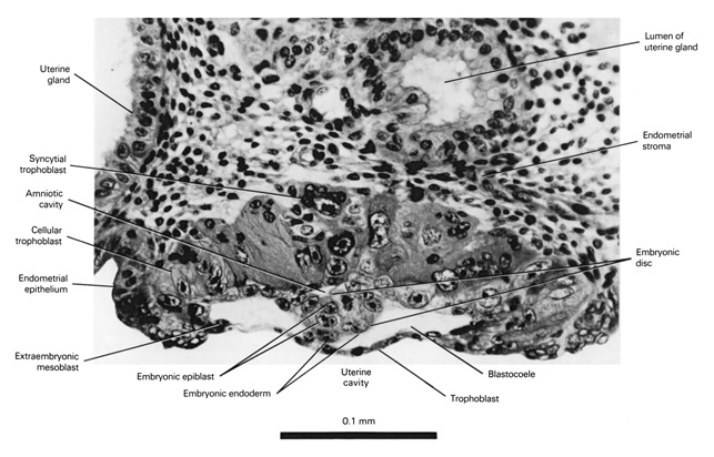 Open PDF version of FIG 1-4, The partially implanted (bilaminar) blastocyst with adjacent uterine wall