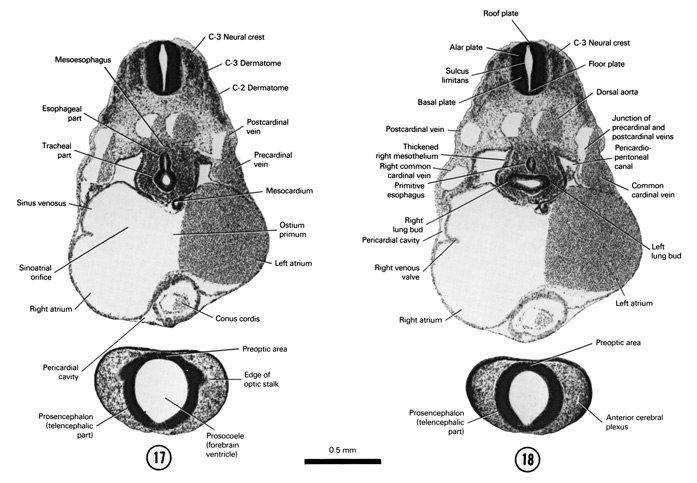 Open PDF version of FIG 5-14, A section through the middle of the C-3 neural crest, telencephalic part of the prosencephalon and cranial part of the sinus venosus. A section through the C-3 neural crest and the separation of the tracheoesophageal tube.