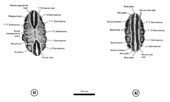 Open PDF version of FIG 5-26, A section through the T-10–L-2 dermatomes and a longitudinal section of the notochord. A longitudinal section of the basal plate of the spinal cord at the level of the T-11–L-2 dermatomes.