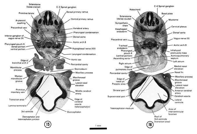 . Journal of comparative neurology . Fig. 11 Parasagittal section near  median surface of mandibular nerve, embryoof pig 17 mm. in length. E,  eustachian tube; Jug, jugular vein; Man, mandibu-lar nerve; Ot, otic  ganglion; *S, semilunar ganglion. Fig. 12