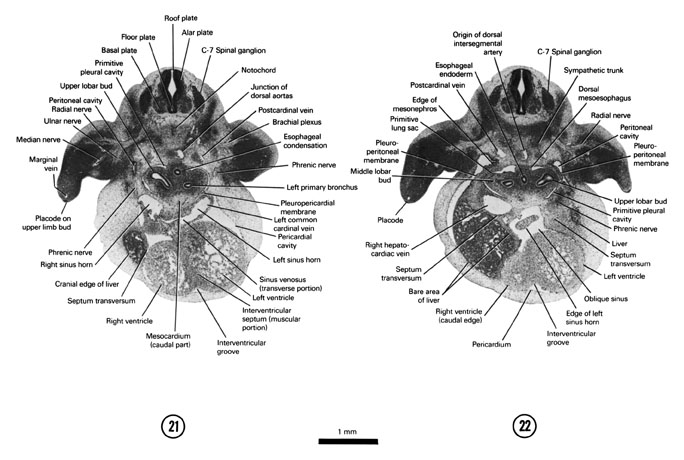 Open PDF version of FIG 6-16, A section through the C-7 spinal ganglion and left sinus horn. A section through the pleuroperitoneal membrane and the cranial edge of the mesonephros.