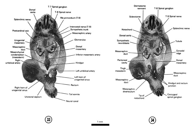 Open PDF version of FIG 6-22, A section through the horns of the urogenital sinus near their junction with the mesonephric duct. A section through the T-8 and coccygeal spinal ganglia.