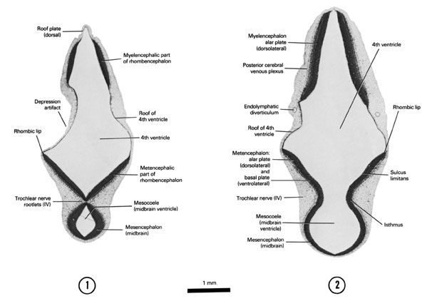 Open PDF version of FIG 6-6, A section through the roof of the fourth ventricle and origin of the trochlear nerve. A section through the mesencephalic isthmus and tip of the endolymphatic diverticulum.