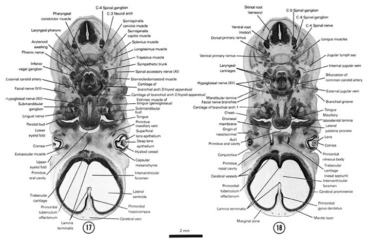 Open PDF version of FIG 7-14, A section through the extrinsic tongue muscles and hyoid apparatus (second and third arch cartilages). A section through the laryngeal cartilages and caudal part of the primitive nasal cavity.