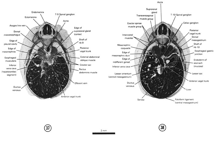 Open PDF version of FIG 7-24, A section through the T-9 spinal ganglion and the cranial edge of the mesonephros. A section through the T-10 spinal ganglion and the esophageal-gastric junction.