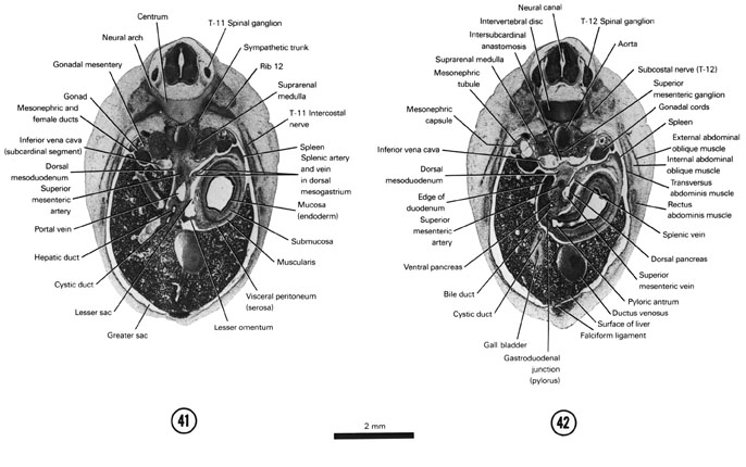 Open PDF version of FIG 7-26, A section through the middle of the lesser sac. A section through the T-12 spinal ganglion and gastroduodenal junction.