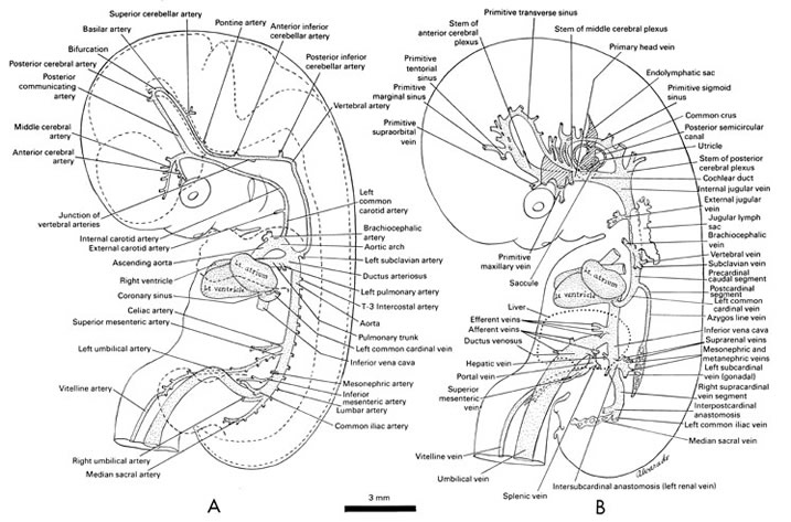 Open PDF version of FIG 7-5, Cardiovascular system of the 18-mm embryo.