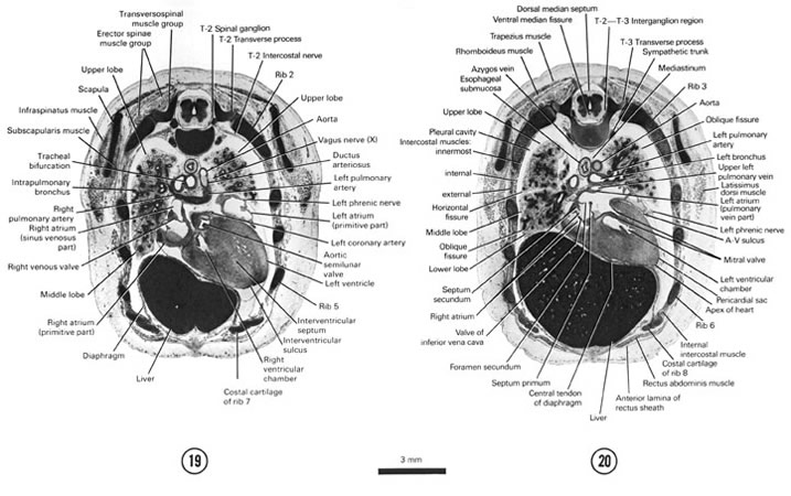 Open PDF version of FIG 8-12, A section through the cranial edge of the liver and diaphragm, tracheal bifurcation and T-2 spinal ganglion. A section through the apex of the heart, root of the lungs and T-2–T-3 interganglion region.